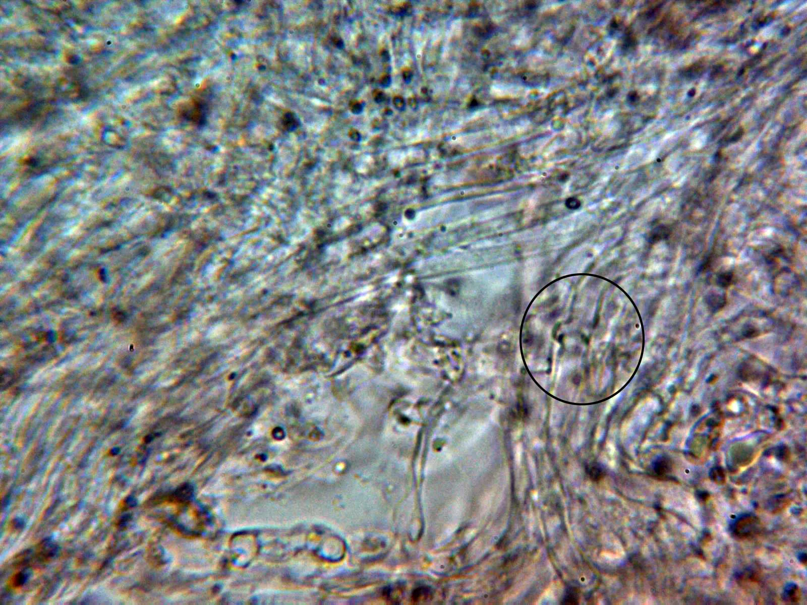 Microscopía de Ramaria cedretorum - 15 - Trama con fíbula